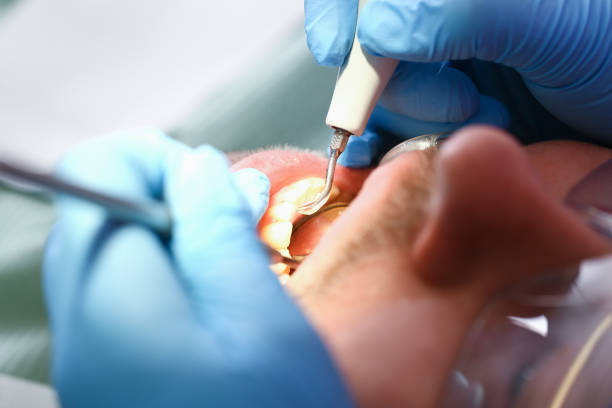 Best Emergency Tooth Extraction  in Ludowici, GA