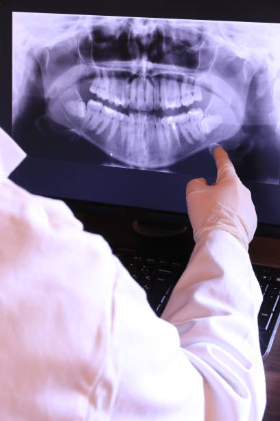 Best Emergency Dental Filling Replacement  in Ludowici, GA