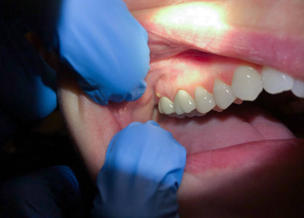 Best Urgent Tooth Repair  in Ludowici, GA