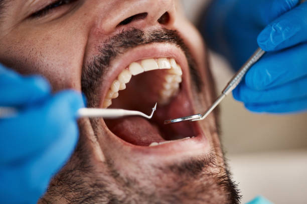 Best Cracked Tooth Emergency Dentist  in Ludowici, GA